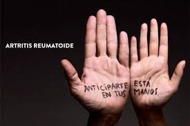 Cómo vencer la artritis reumatoide