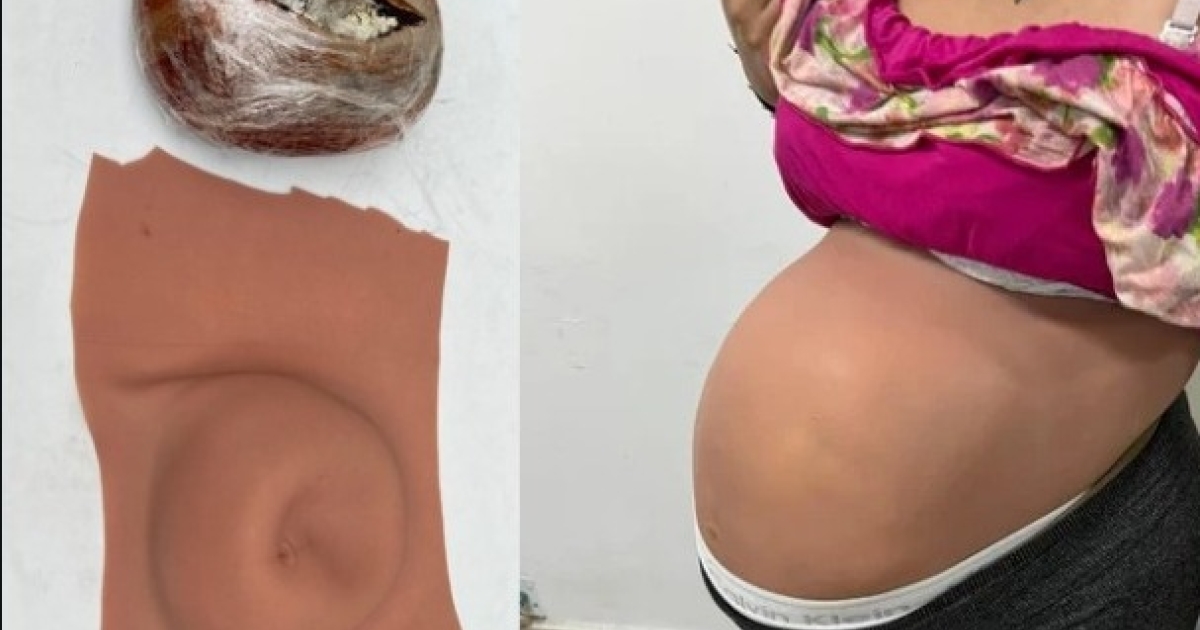 Capturan en Cali a mujer con droga en 'narco-barriga'