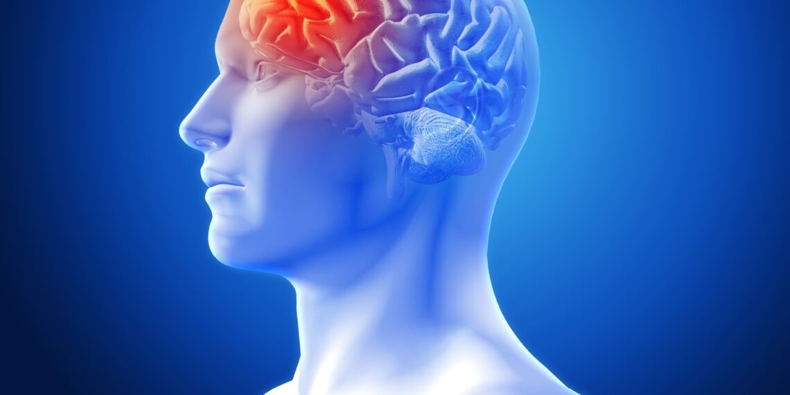 Aumenta la incidencia de ACV precoz en adultos jóvenes: alerta médica y jornada de prevención en Caracas